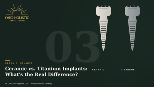 Ceramic vs. Titanium Implants: What's the Real Difference