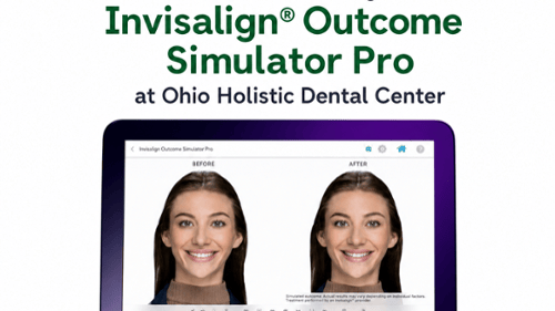 itero simulator, see your smile make over first 