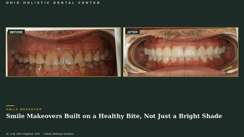 Smile Makeover Built on a Healthy Bite, Not Just a Bright Shade , broken teeth, worn down teeth