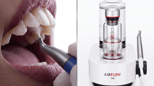 airflow dental cleaning - guided biofilm therapy 