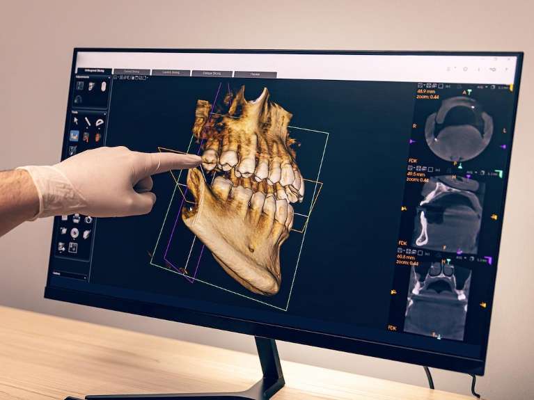 Carestream Cone Beam Computed Tomography (CBCT) at ohio holistic dental center, centerville oh