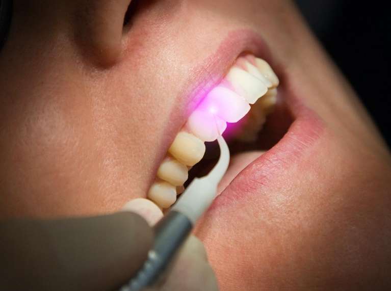 Fotona Dual Wavelength Hard & Soft Tissue Laser at ohio holistic dental center, centerville oh