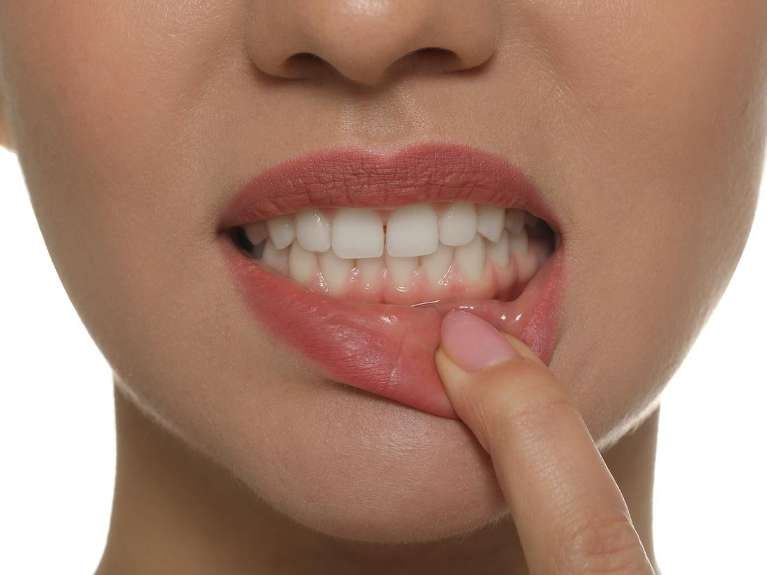Ozone Therapy at ohio holistic dental center, centerville oh